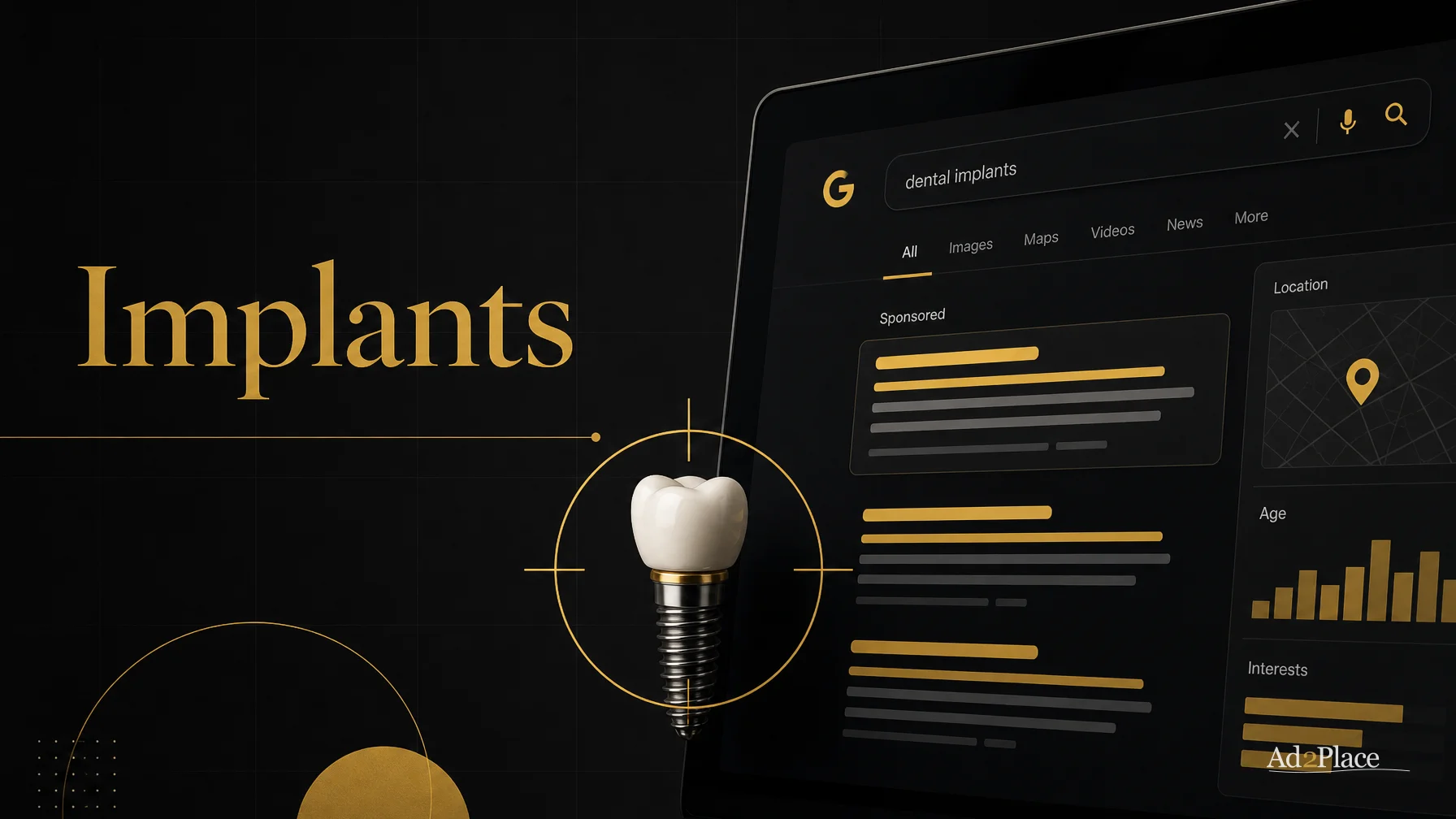 Google Ads for dental implants: campaign structure, negative keywords and landing pages with health-advertising compliance